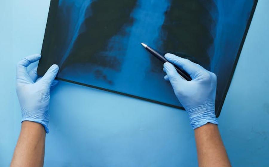medical xray of lungs, with gloved hands pointing to one area